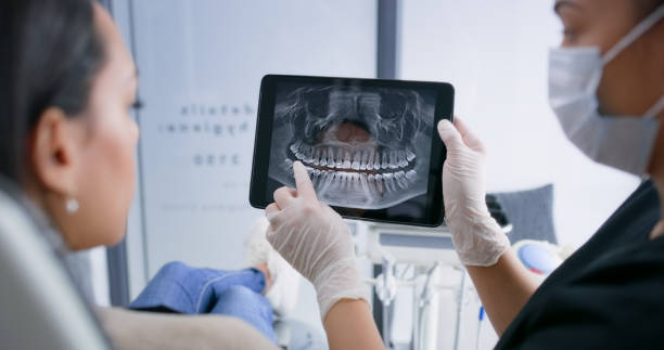 Licensed Wisdom Tooth Removal service in Dayton, OH - Smile Center Dentistry